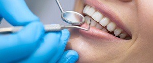 preventive dental appointment