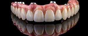 implant dentures with a black background