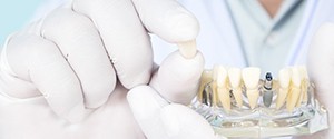 Dentist holding final restoration for dental implant in Agawam 