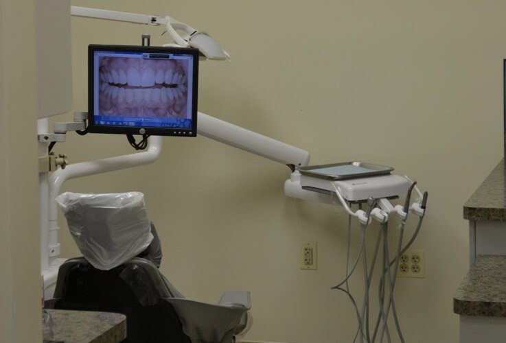 Digital xrays at Lifetime Dental of Agawam