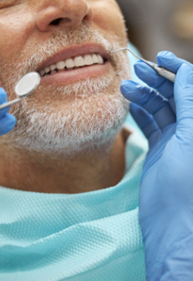 Man with white facial hair about to undergo dental exam