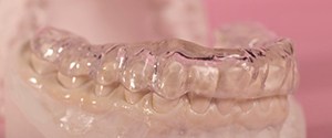 Model teeth wearing occlusal splint