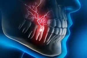 An image of a tooth with pain radiating from it