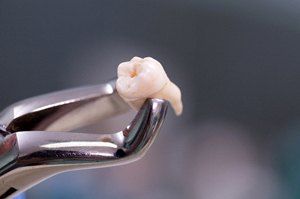 An extracted tooth
