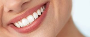 Closeup of woman with white teeth smiling 