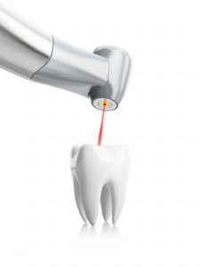 laser dentistry