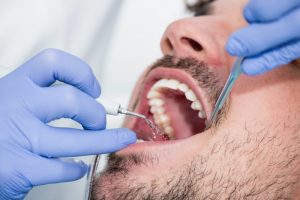 a man getting a dental cleaning in Agawam