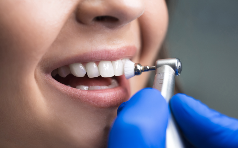 Close up of patient's smile at teeth cleaning